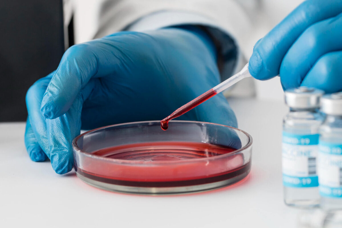 Un nou test de sânge, numit Mionco-DX, ar putea descoperi cancerul mult mai devreme!