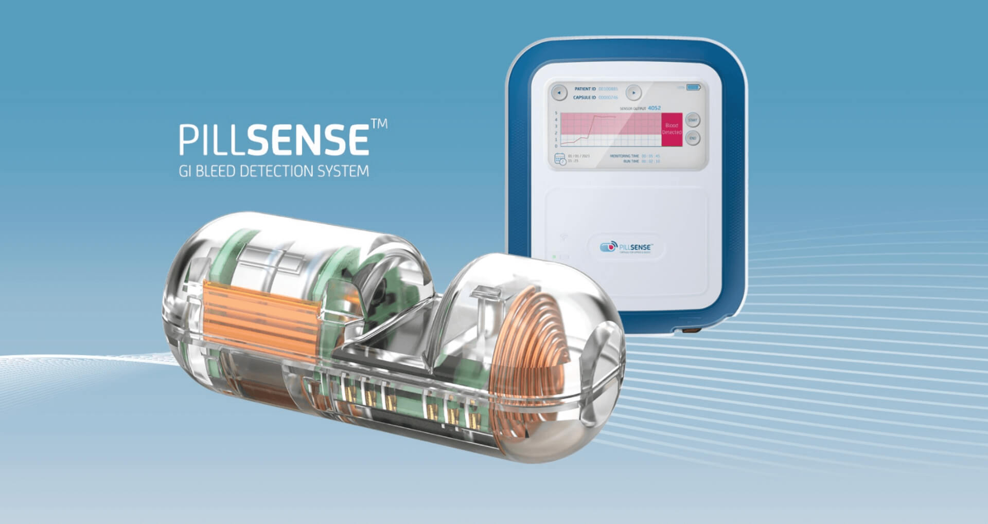 Rapid and non-invasive detection of upper gastrointestinal bleeding ...